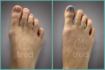 before and after photo