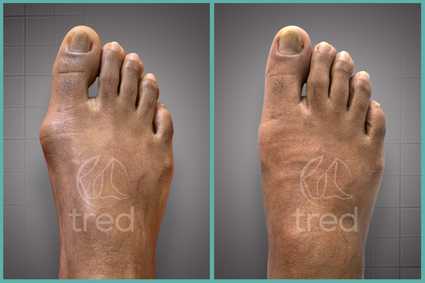 before and after photo