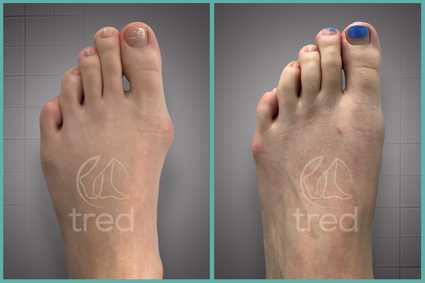 before and after photo