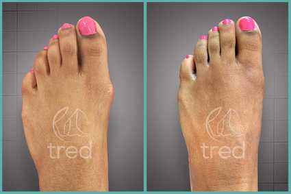 before and after photo