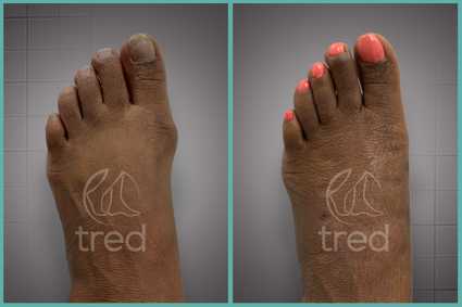 before and after photo