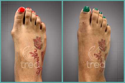 before and after photo