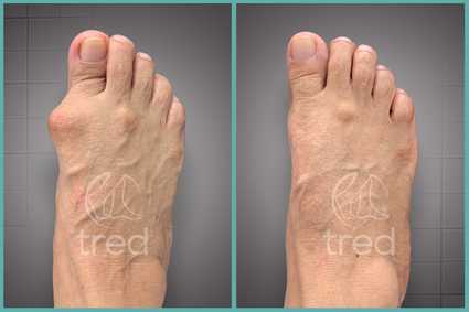 before and after photo