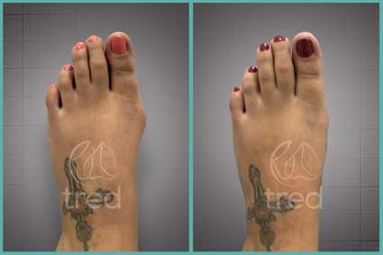 before and after photo